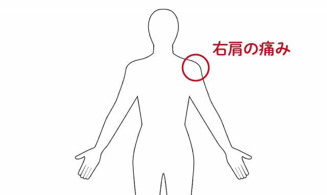 右肩の痛み